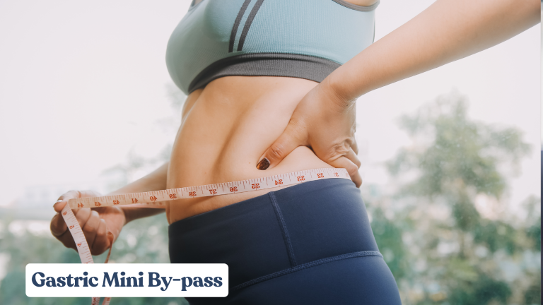 Gastric Mini By-pass