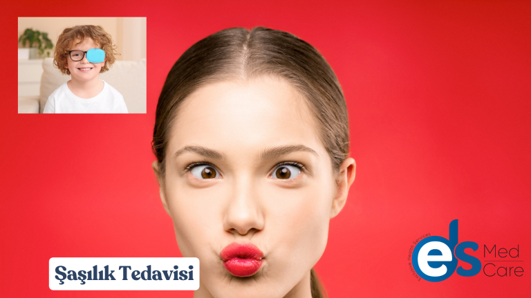 Çocuklarda Şaşılık Tedavisi