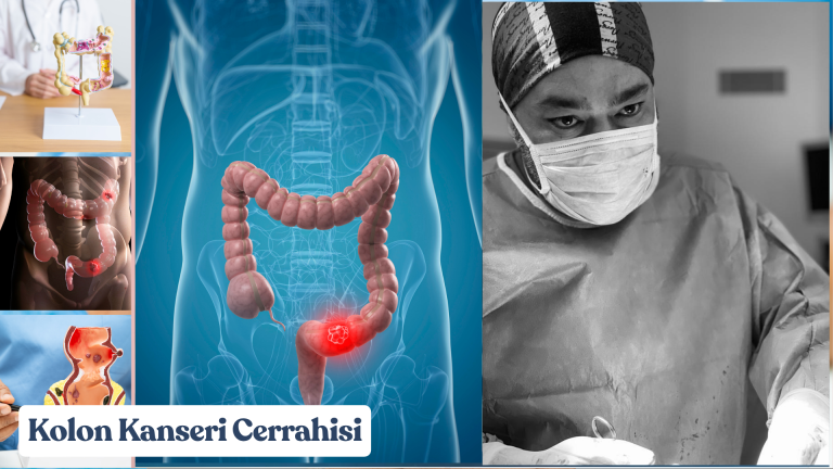 Kolon Kanseri Cerrahisi: Bilimsel Disiplin, Cerrahi Ustalık ve Yaşamın Yeniden Başlangıcı